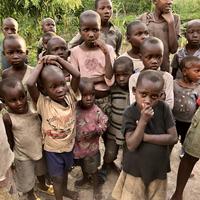 Mangelernährte Kinder in Burundi.